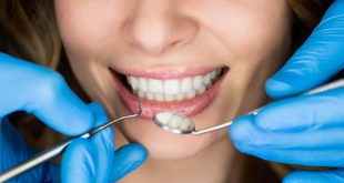 Имплантация зубов, на что обратить внимание